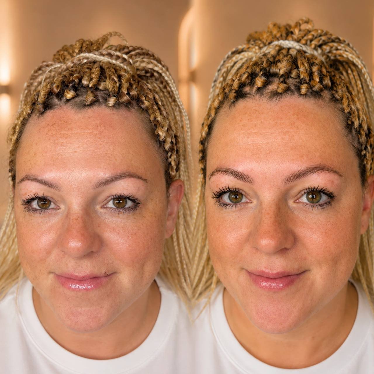 This transformation features ultra-natural hair stroke brows designed to mimic real brow hairs. Perfect for clients who want realistic texture, soft fullness, and effortless definition without the look of makeup. The result is fresh, natural brows that blend seamlessly with her features